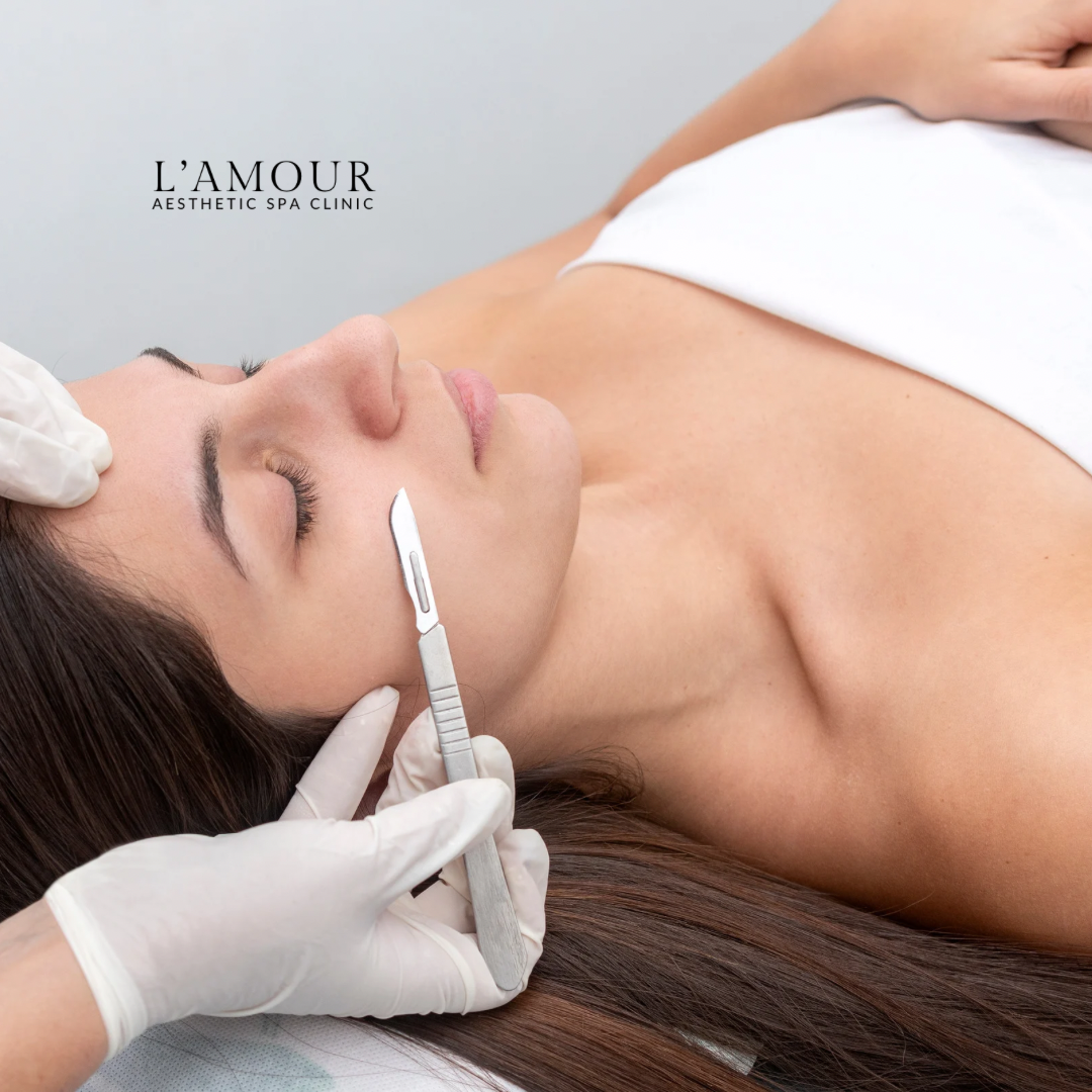 Dermaplaning – 45 min